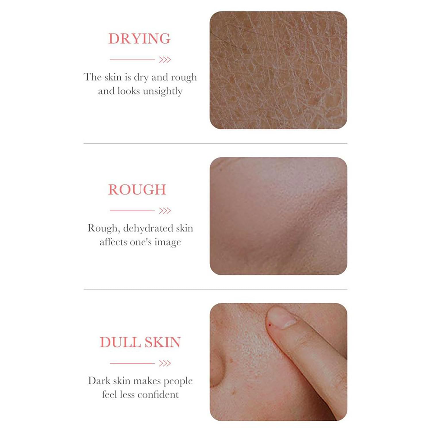 ROSE HYALURONIC ACID 30 ML - Imagen 2